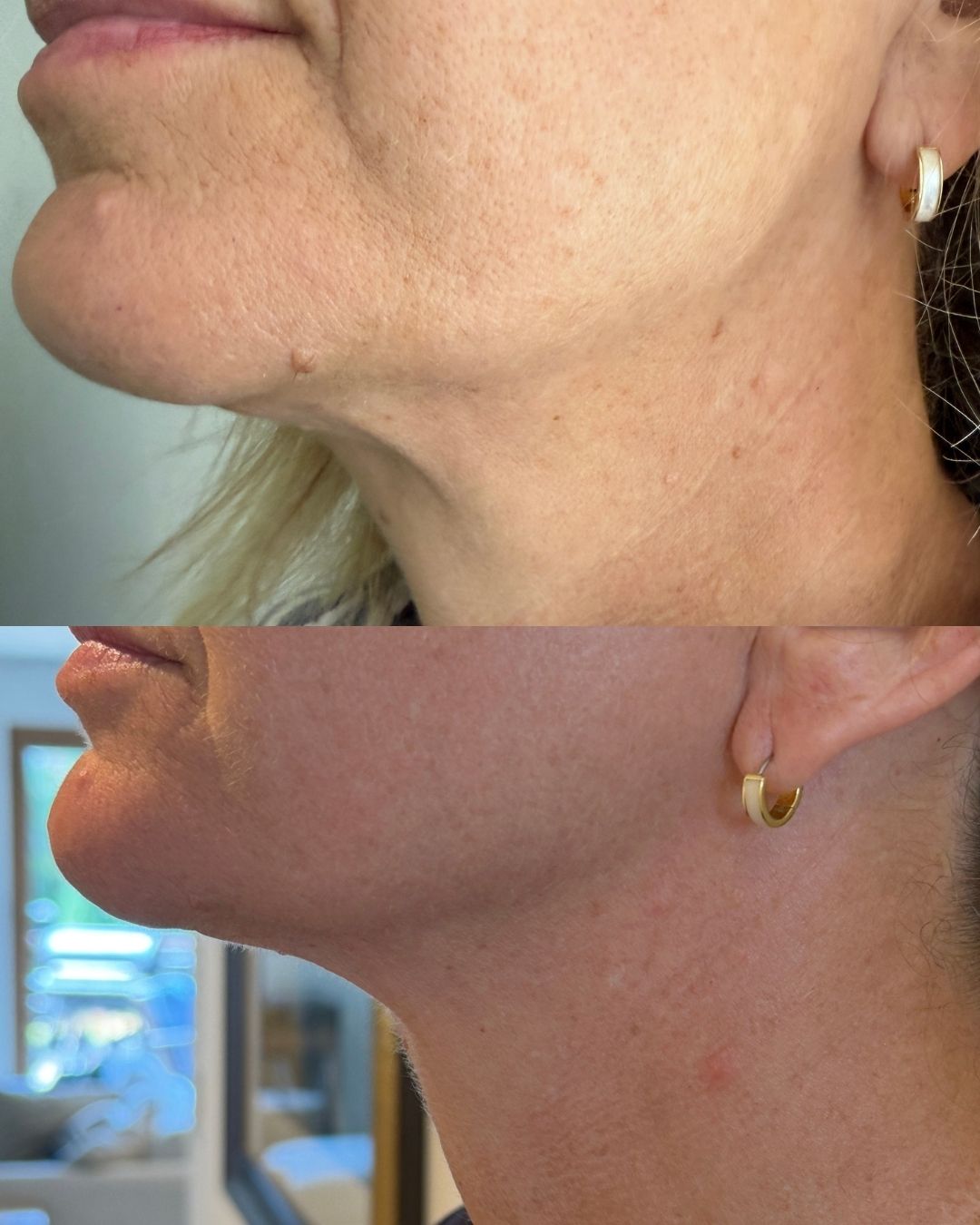 Reduced redness. Refined pores.