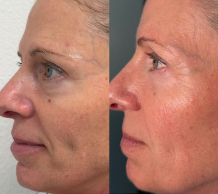 Clearer complexion. Natural radiance.