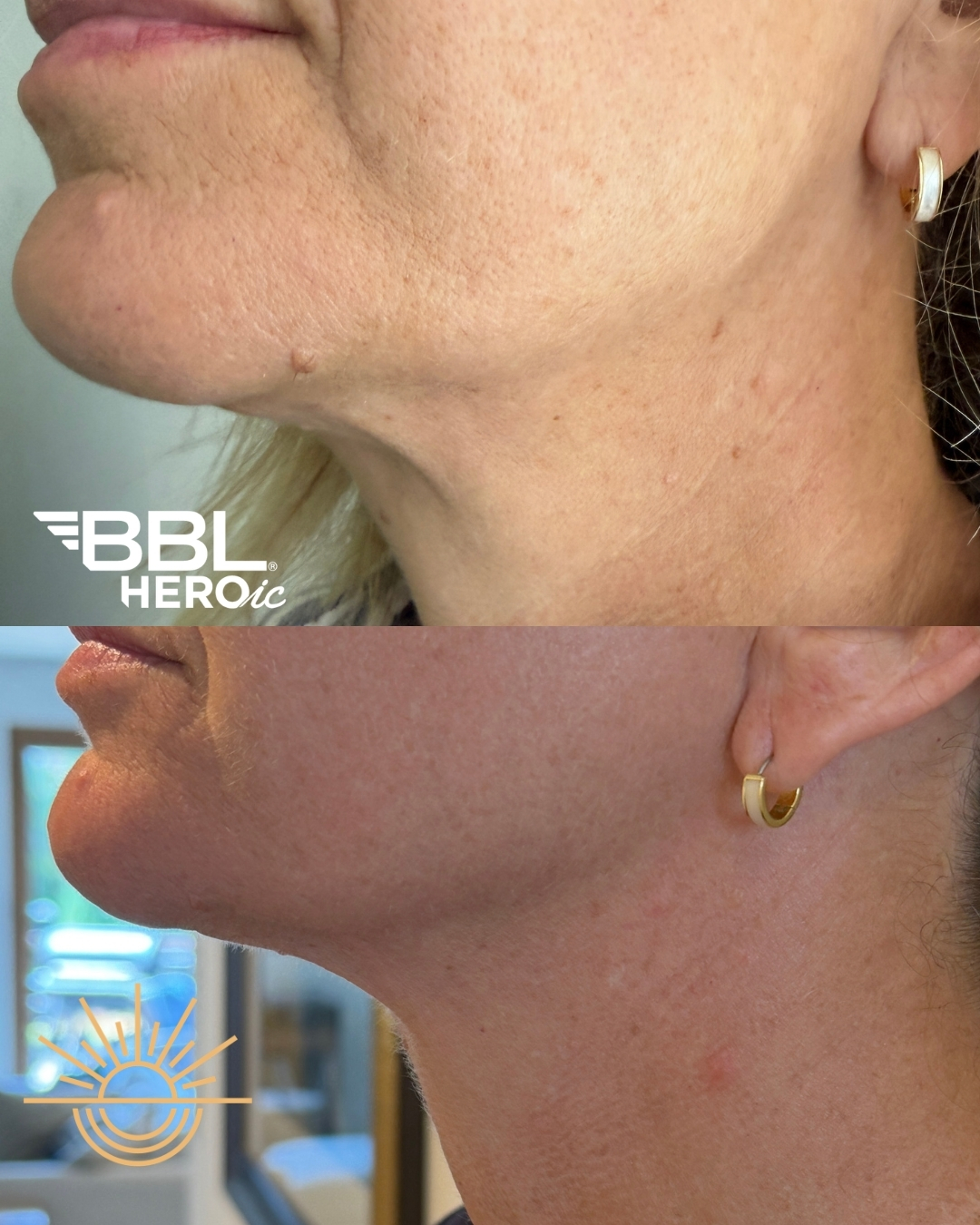 Tighter skin. Softer texture.