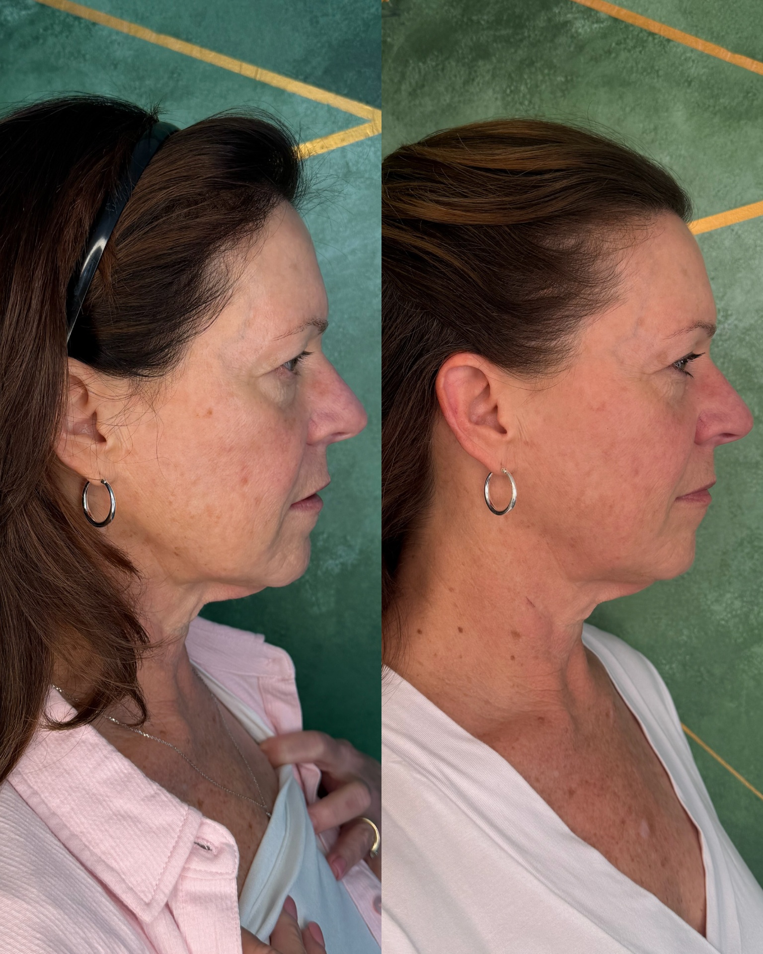 Even skin. Refreshed glow.